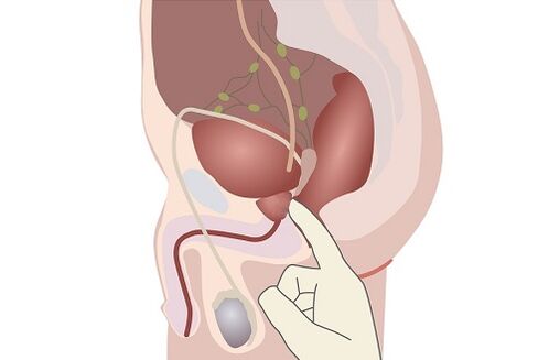 anatomia da próstata masculina